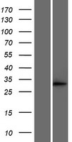 ls001632 dci eci1 human over expression lysates nm 001178029 wb testing 1