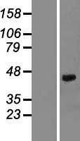 Decorin (DCN) Human Over-expression Lysates NM_001920
