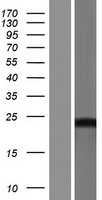 DCTD Human Over-expression Lysates NM_001012732