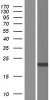DCTD Human Over-expression Lysates NM_001921