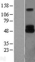 TRP2 (DCT) Human Over-expression Lysates NM_001922