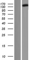 DCTN1 Human Over-expression Lysates NM_001135040