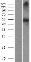 DOPA Decarboxylase (DDC) Human Over-expression Lysates NM_000790