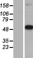 DOPA Decarboxylase (DDC) Human Over-expression Lysates NM_001082971