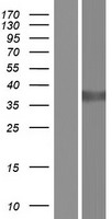 ls001645 akr1c1 human over expression lysates nm 001353 wb testing 1