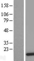 DDT Human Over-expression Lysates NM_001355