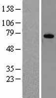 DDX3 (DDX3X) Human Over-expression Lysates NM_001356