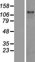 DHX8 Human Over-expression Lysates NM_004941