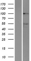 ls001662 ddx10 human over expression lysates nm 004398 wb testing 1