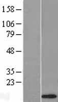 alpha Defensin 1 (DEFA1) Human Over-expression Lysates NM_004084