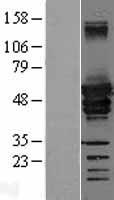 Desmin (DES) Human Over-expression Lysates NM_001927