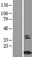 ls001678 timm8a human over expression lysates nm 004085 wb testing 1
