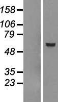 GSDME Human Over-expression Lysates NM_001127453