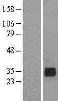 ls001716 deoxyguanosine kinase dguok human over expression lysates nm 080916 wb testing 1