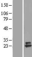 ls001716 deoxyguanosine kinase dguok human over expression lysates nm 080918 wb testing 2