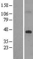 DHCR7 Human Over-expression Lysates NM_001163817