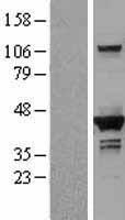 ls001725 dhps human over expression lysates nm 001930 wb testing 1
