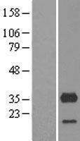 CYB5R3 Human Over-expression Lysates NM_000398
