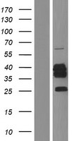 CYB5R3 Human Over-expression Lysates NM_001171660