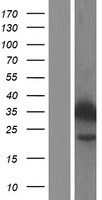 CYB5R3 Human Over-expression Lysates NM_007326