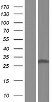 NQO1 Human Over-expression Lysates NM_001025434