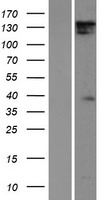 DIAPH1 Human Over-expression Lysates NM_005219