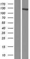 DIAPH2 Human Over-expression Lysates NM_006729