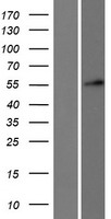 DKC1 Human Over-expression Lysates NM_001142463