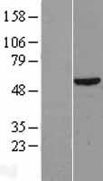 DKC1 Human Over-expression Lysates NM_001363