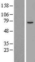 Pyruvate Dehydrogenase E2 (DLAT) Human Over-expression Lysates NM_001931