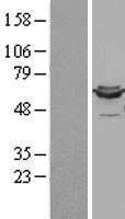 ls001738 lipoamide dehydrogenase dld human over expression lysates nm 000108 wb testing 1