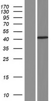 ls001740 psd93 dlg2 human over expression lysates nm 001142702 wb testing 2