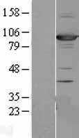 SAP102 (DLG3) Human Over-expression Lysates NM_021120