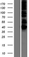 DLST Human Over-expression Lysates NM_001933