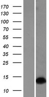 DLX1 Human Over-expression Lysates NM_001038493