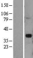 DLX2 Human Over-expression Lysates NM_004405