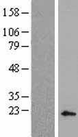 DLX4 Human Over-expression Lysates NM_001934