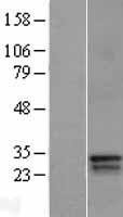 DLX4 Human Over-expression Lysates NM_138281