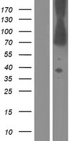 Dystrophin (DMD) Human Over-expression Lysates NM_004015