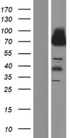 Dystrophin (DMD) Human Over-expression Lysates NM_004017