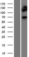 Dystrophia myotonica protein kinase (DMPK) Human Over-expression Lysates NM_001081562
