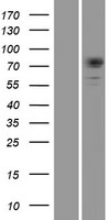 Dystrophia myotonica protein kinase (DMPK) Human Over-expression Lysates NM_004409