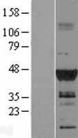 DMRT1 Human Over-expression Lysates NM_021951