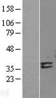 Deoxyribonuclease I like 1 (DNASE1L1) Human Over-expression Lysates NM_001009933