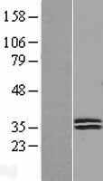 Deoxyribonuclease I like 1 (DNASE1L1) Human Over-expression Lysates NM_001009934