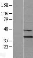 ls001776 dnase gamma dnase1l3 human over expression lysates nm 004944 wb testing 1