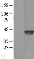 DNase II (DNASE2) Human Over-expression Lysates NM_001375
