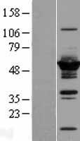 DYNC1LI2 Human Over-expression Lysates NM_006141