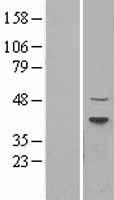 Dnmt2 (TRDMT1) Human Over-expression Lysates NM_004412