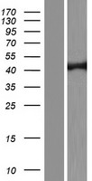 Dnmt2 (TRDMT1) Human Over-expression Lysates NM_176083